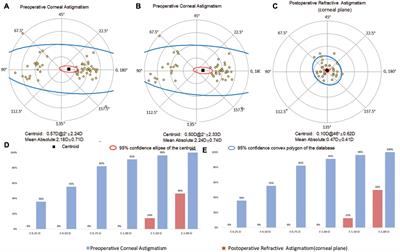 Total keratometry for toric intraocular lens calculation: comparison from two swept-source optical coherence tomography biometers